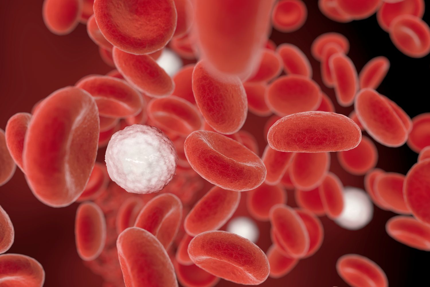 Thalassemia
